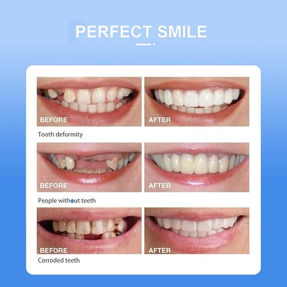 Snap On Smile  Veneers Teeth For Men And Women  Moldable False Artificial Braces Teeth