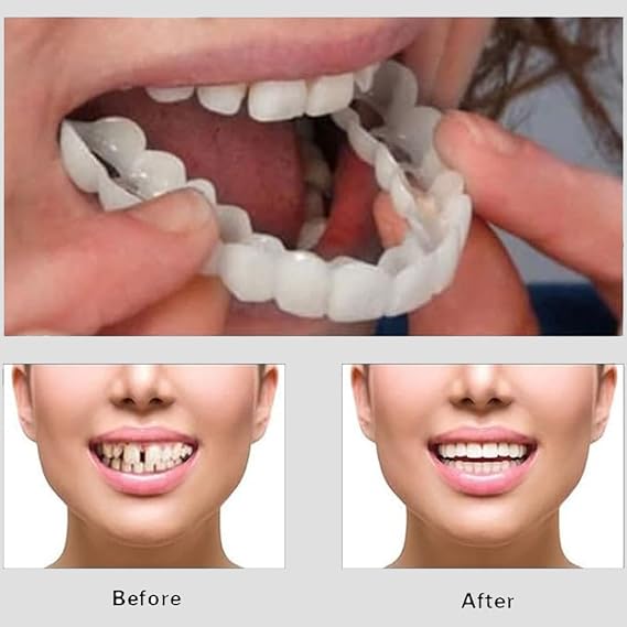 Snap On Smile  Veneers Teeth For Men And Women  Moldable False Artificial Braces Teeth